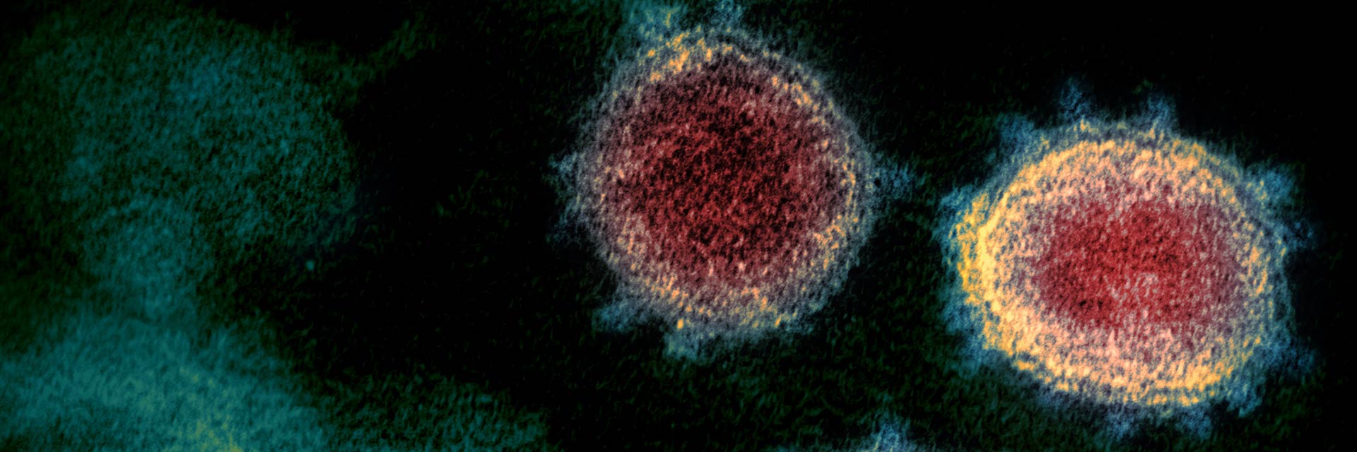 Δήμος Μαλεβιζίου Covid-19